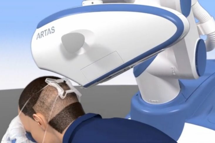 ARTAS-Robot-compressor